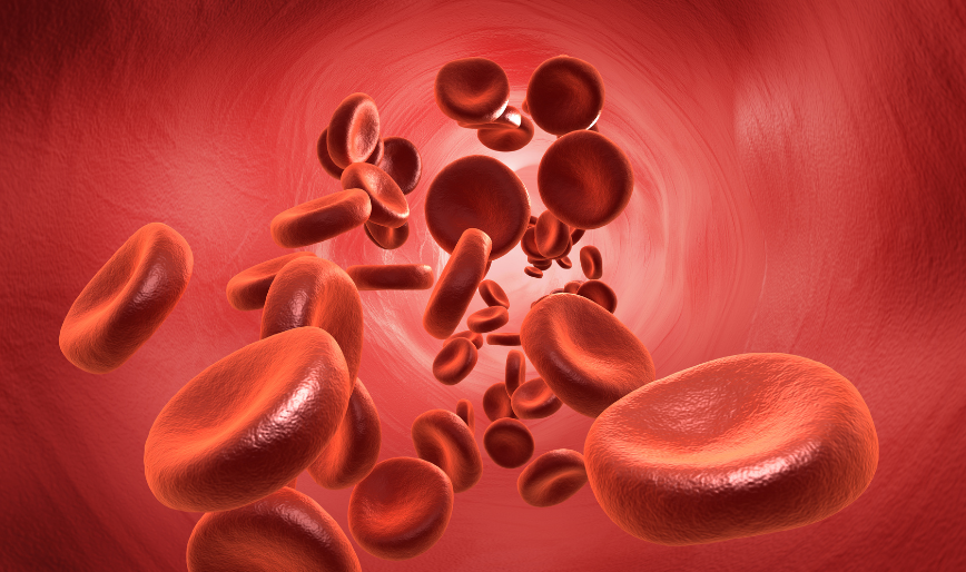 Sickle Cell Anemia