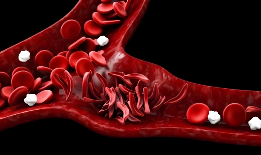 Lymphoma Care